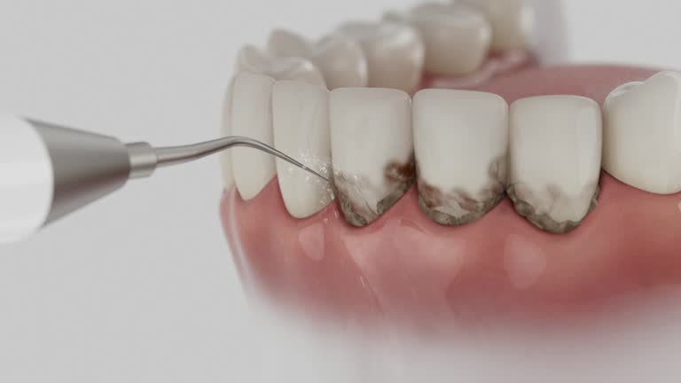 Reliable Dental Implants contractor in North Patchogue, NY by Smile Center Dentistry